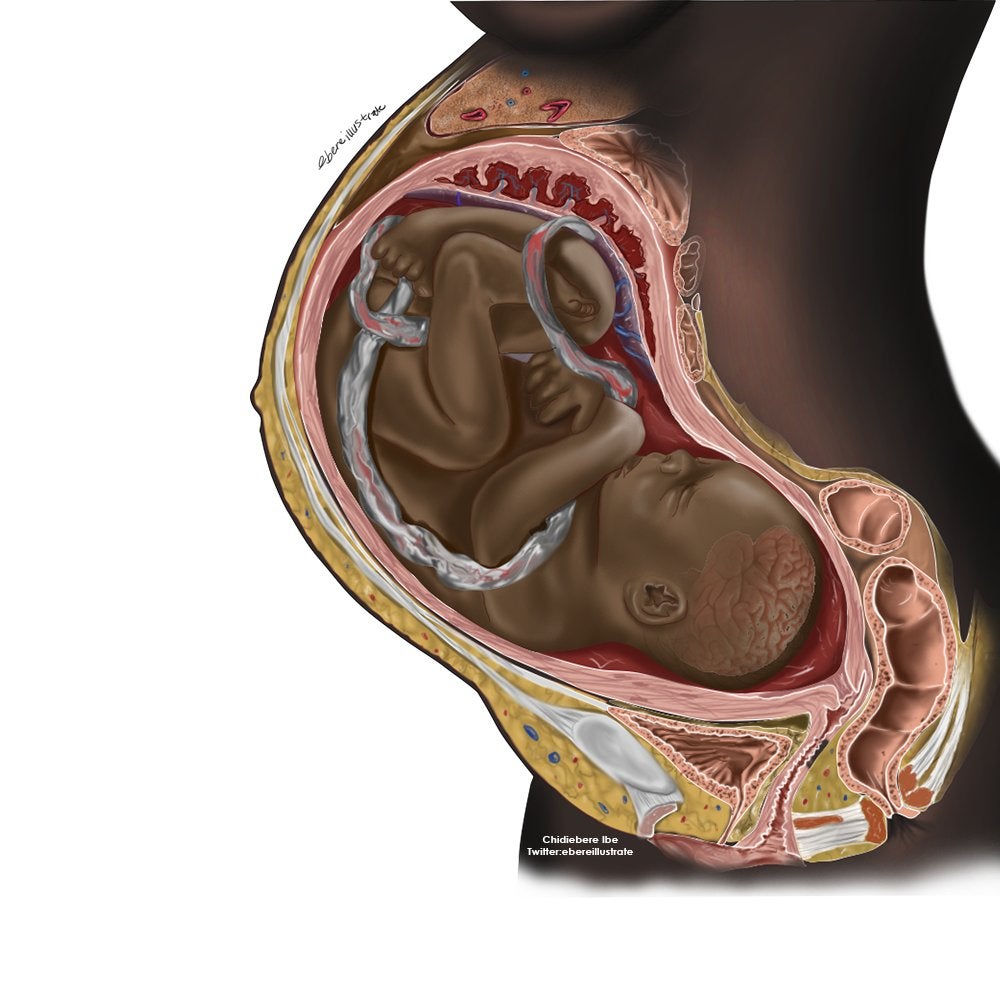 Aspiring Black Neurosurgeon Creates Medical Illustrations Showing Black People