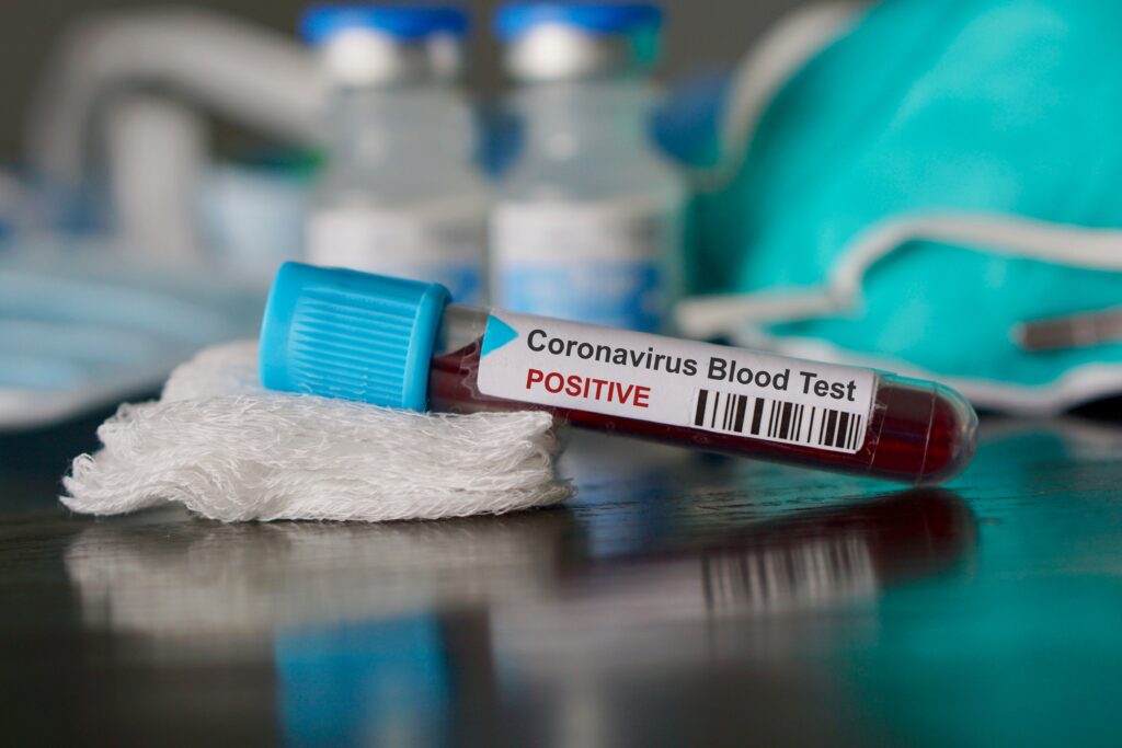 75 NFL Players (and Counting) Have COVID-19—and the NBA Isn’t Far Behind