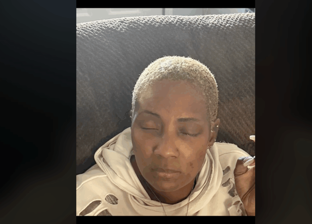 A North Carolina Woman Mistakes Nail Glue for Eye Drops and…Ouch!