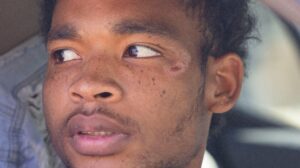 21-Year-Old Texas Man Who Was Brutally Beaten During Arrest Speaks