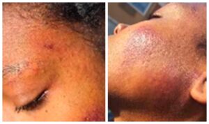 Woman Punched by Charlotte Police in Viral Video Speaks Out
