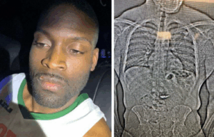 Fla. Man Accused of Smuggling Tiffany Jewelry Had a Disturbing Hiding Place for It