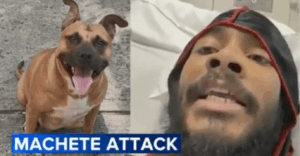 This Bronx Man Lost Four Fingers Protecting His Puppy From Who?!