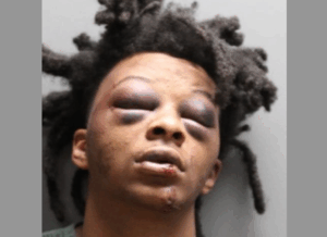 Jacksonville Sheriff Releases New Details Behind Brutal Beating