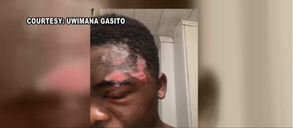 Victim of Alleged Police Brutality Incident Won’t Receive Justice, but He Won’t be Charged With Any Crimes Either